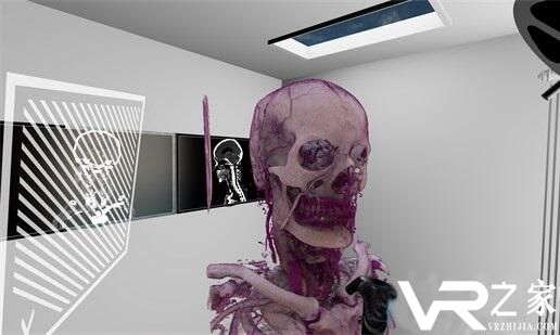 SpectoVive截图 (1)