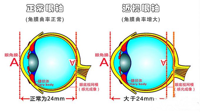 眼睛损伤是VR眼镜的锅视力越好伤害越大敢信.jpg