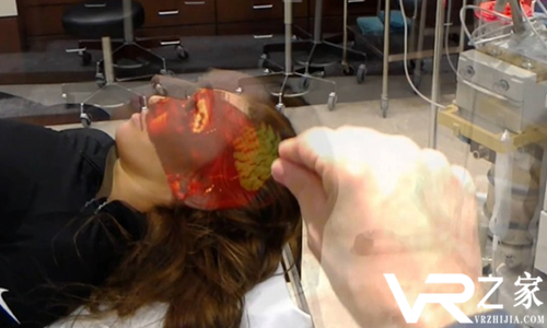 神经放射手术第一次使用HoloLens，有望成为手术室标配.png