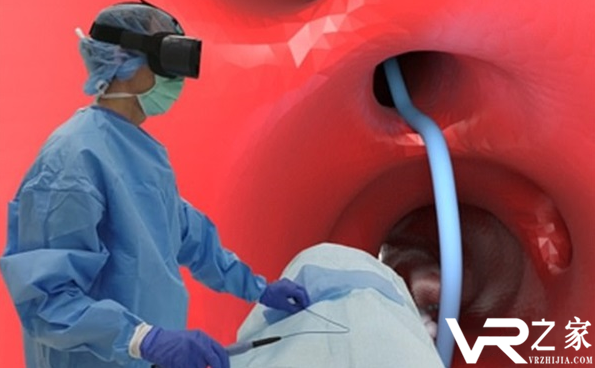 VR新技术让医生无需X光即可进行血管造影